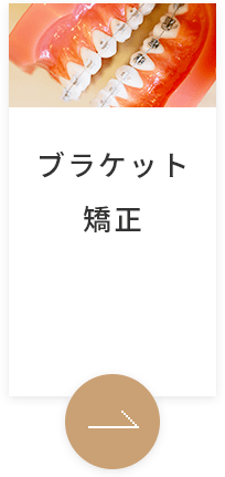 ブラケット矯正